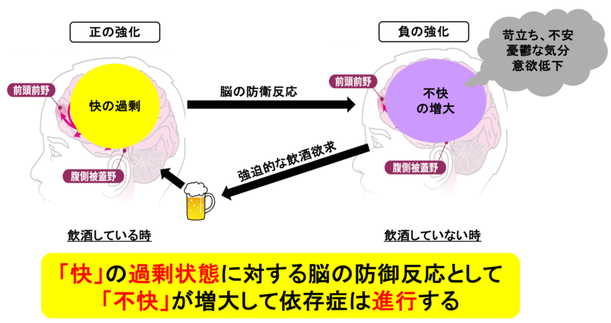 依存症の進行メカニズム